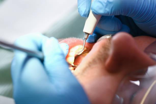 Best Emergency Treatment for Toothache in Newton, NJ