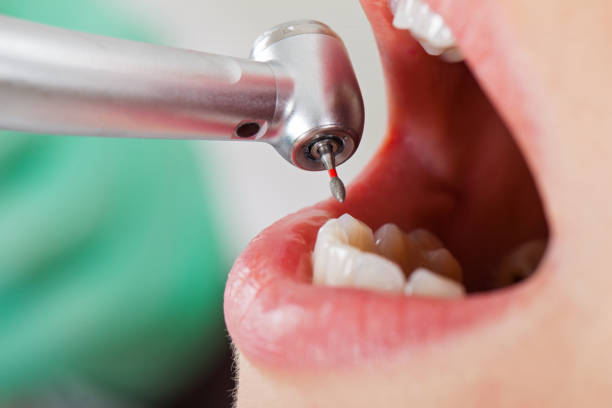 Best Emergency Broken Tooth Repair in Newton, NJ